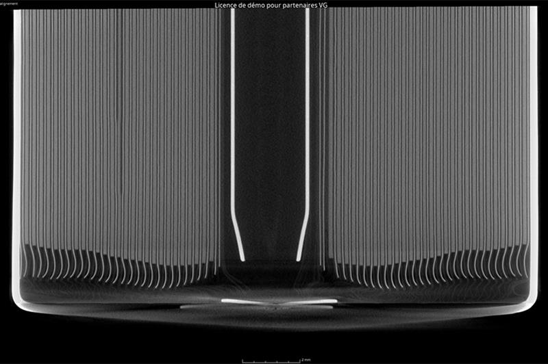 Calculation and analysis of overhang on lithium cells